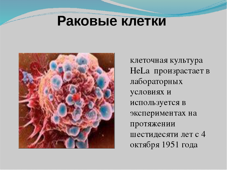 Чего боятся раковые. Раковая клетка строение. Раковые клетки и Здоровые. Строение раковой клетки. Строение раковой Алетка.