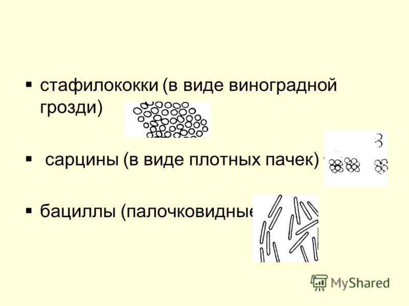 Бактерии относятся к. Царство дробянки. Подцарство бактерии. Биология 7 класс Подцарство настоящие бактерии. Подцарства бактерий таблица 7 класс. Представители подцарства настоящие бактерии.