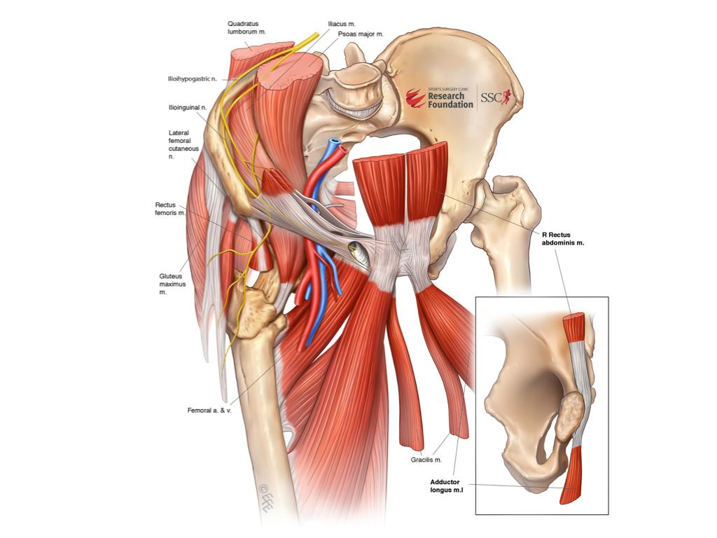 Мышцы сгибатели тазобедренного сустава